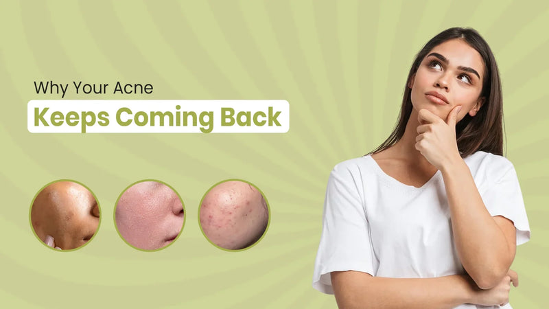 Why Your Acne Keeps Coming Back: Common Causes and What You Can Do About It