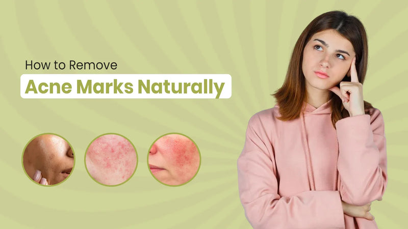 Ingredients You Should Avoid in Skincare