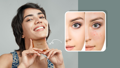 The Complete Guide For The Best Fuzed Acne Soap Bar 