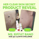Fused Anti Acne Facewash before and after 14 days skin acne reduction results