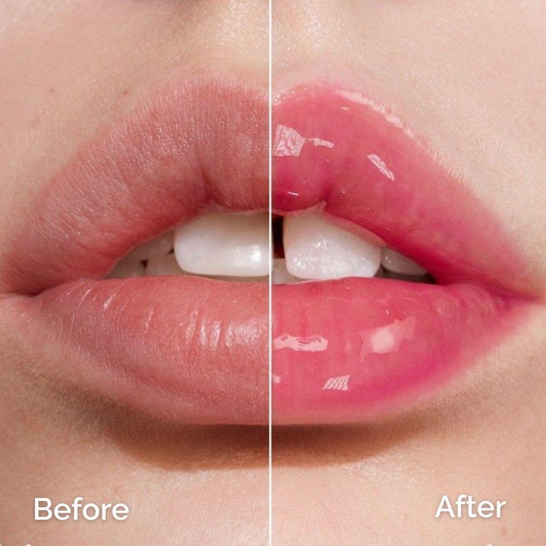 Lip Peptide Balm with SPF 15 – Hydrating & Sun Protecting Lip Treatment (Tinted) - Fuzed Skincare