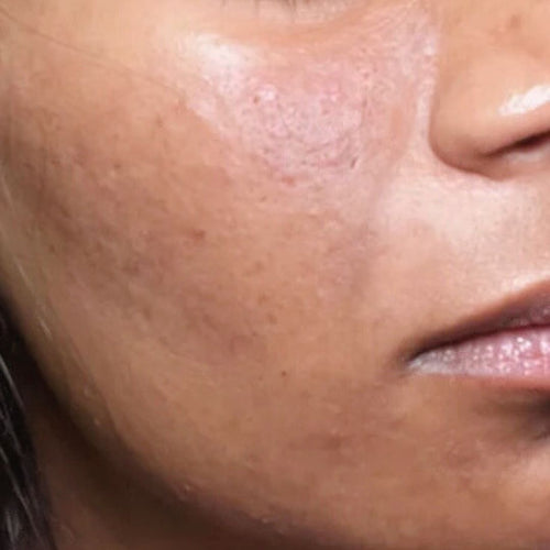 After Screen UV60 w/ Aloe Vera (SPF 60)