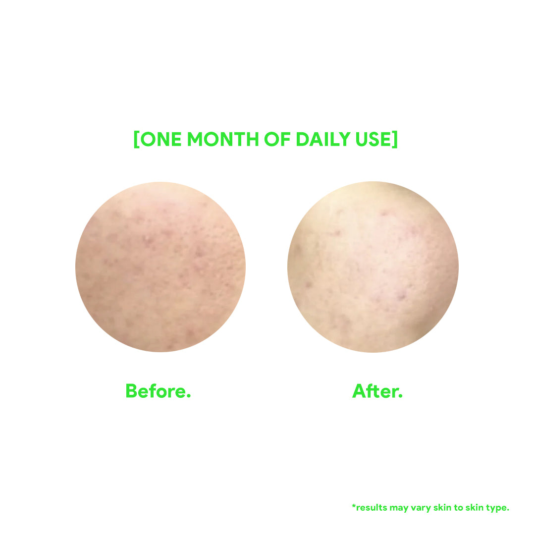 Rose Setting Spray with Aloe Vera - Fuzed Skincare