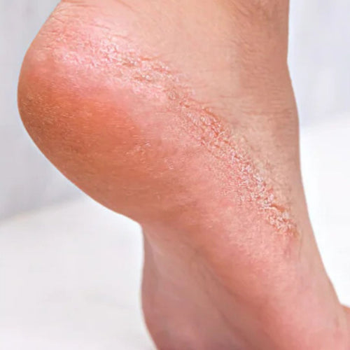 Before Asma Ali Qureshi