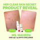 Fused Anti Acne Facewash before and after 14 days skin acne reduction results