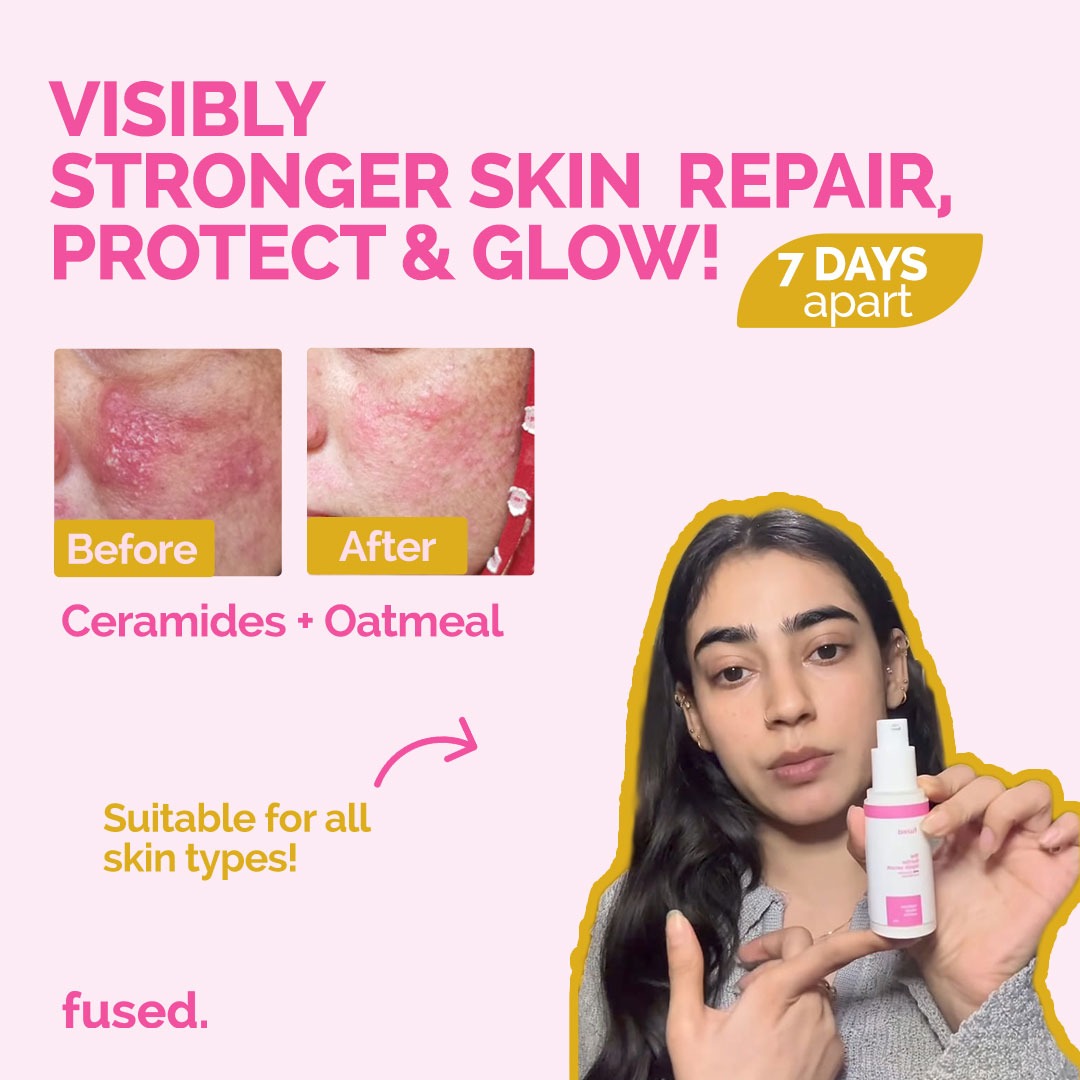 Fused Barrier Repair Serum 7-day before and after results showing skin barrier repair with Ceramides and Oatmeal.