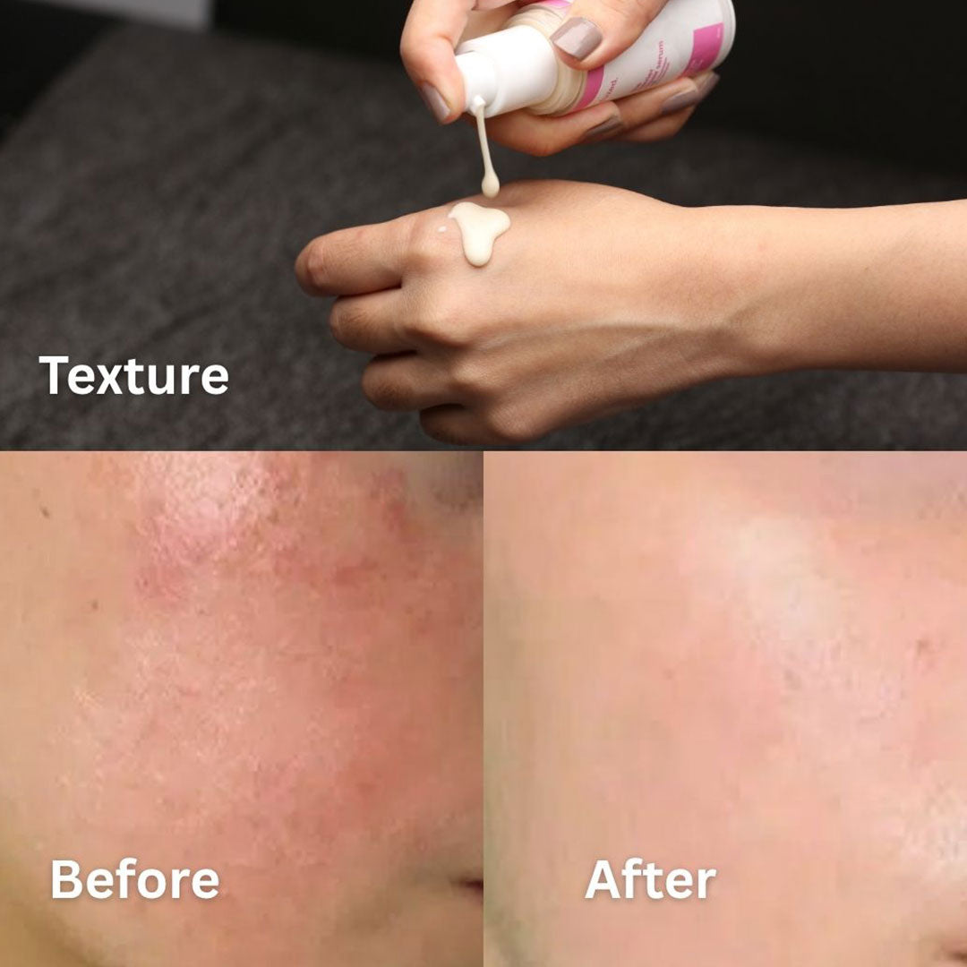 Fused Barrier Repair Serum lotion texture application and before-and-after skin barrier repair results on red, irritated skin.